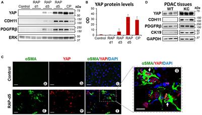 Yes-Associated Protein 1 Plays Major Roles in Pancreatic Stellate Cell Activation and Fibroinflammatory Responses